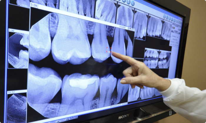 general-dental-treatment-digital-x-rays-2