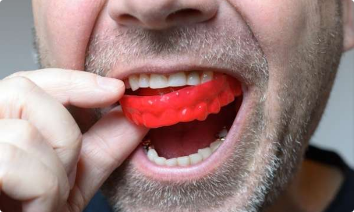 jaw-pain-and-bruxism-mouth-guards-1