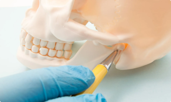 jaw-pain-and-bruxism-tmj-splints-2