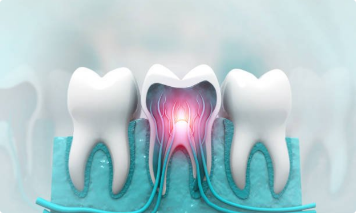 teeth-sensitivity-2